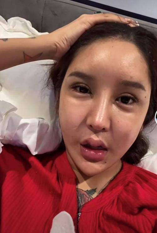 案例:花费百万只为变成赵丽颖,最终不尽人意,医美带来了什么