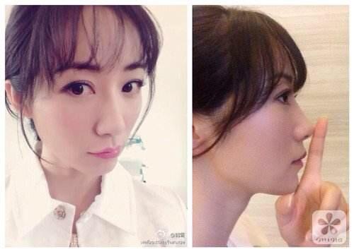 想要隆鼻的我知道这些后……