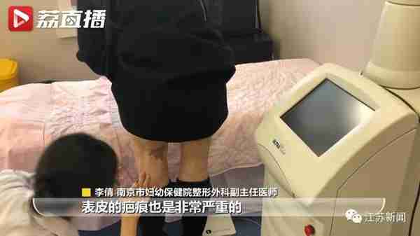 花6万元吸脂后皮肤坏死,双腿凹凸不平!还没修复好,整形医院去哪了?