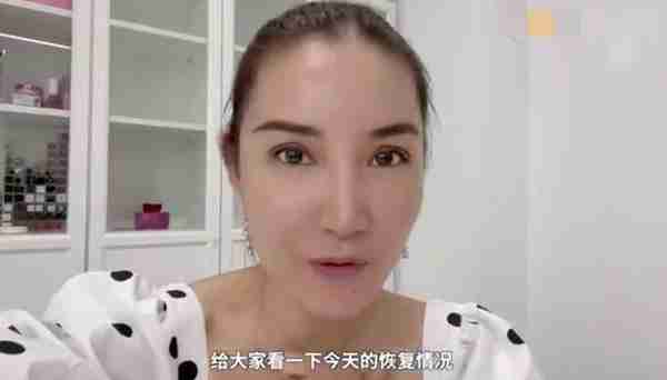 央视女主播自曝整容?晒割双眼皮手术全过程,做完连夸自己变年轻