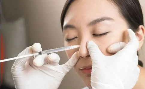 嘴上经常脱口而出的“玻尿酸”,你真的了解它吗?