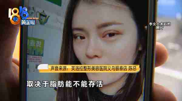 女子130多斤,花3万多抽脂后还是130多斤!医院:效果和个人体质有关,愿意提供二次调整
