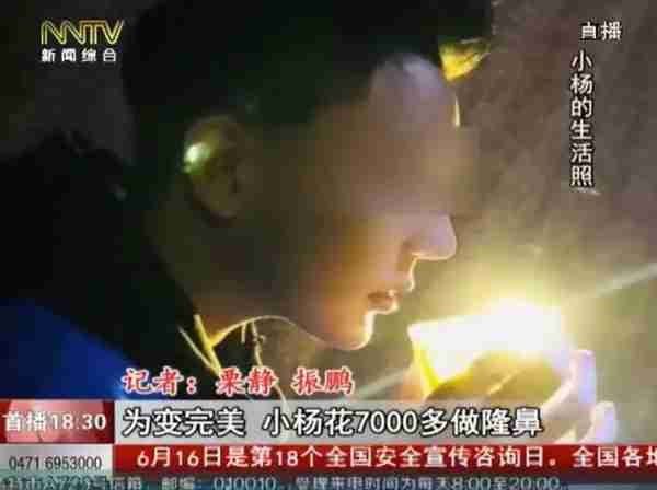 「天天看•热线」术后特别疼!19岁学生花7千多隆鼻,医生竟然说后果很严重