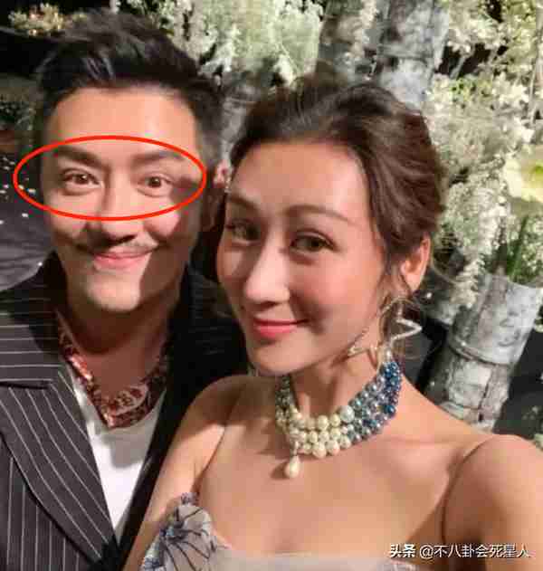 25位明星割过双眼皮,谁自然谁“毁容”一目了然
