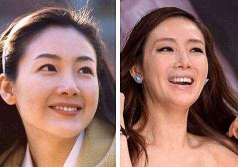 做医美会“上瘾”？经常注射瘦脸针会怎样，爱美是需要付出代价的