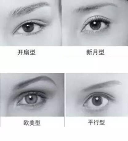 韩誉国都常见双眼皮方式