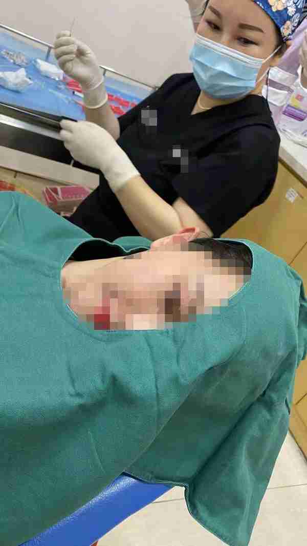 抽脂不当会夺命,“99元一支”“自己就能打”的“水光针”也同样令人不安