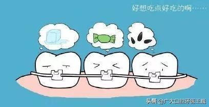 牙齿矫正必看！这些正畸注意事项先了解（1）金属托槽正畸攻略
