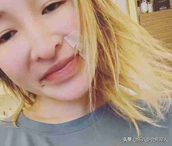 25位明星割过双眼皮,谁自然谁“毁容”一目了然