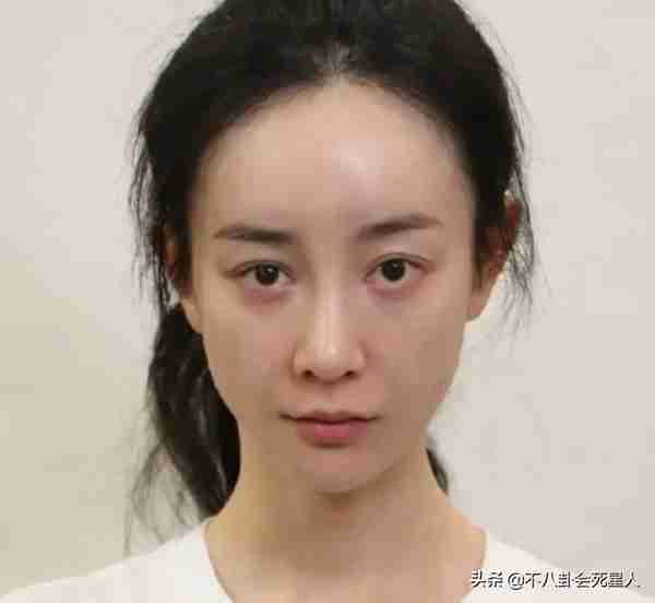 25位明星割过双眼皮,谁自然谁“毁容”一目了然