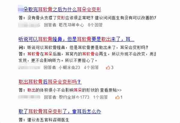 做了耳软骨隆鼻后,我的耳朵会变形吗?