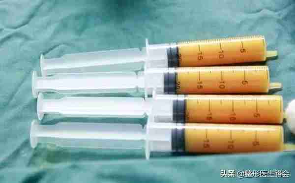 关于自体脂肪填充,那些整形医生不会告诉你的