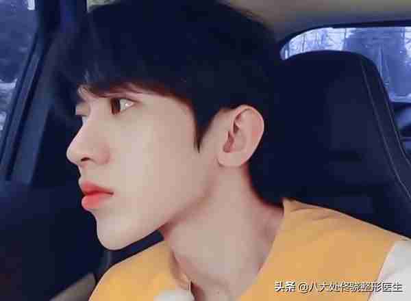 面部一枝花,全靠鼻当家,“一支玻尿酸”解救娱乐圈无数塌鼻梁