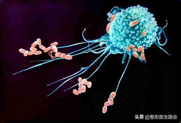 做完膨体鼻最害怕的事:感染与取出!整形医生谈膨体隆鼻的后遗症