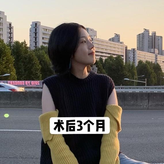 韩国医生整形日记:半肋软骨鼻修复案例分享
