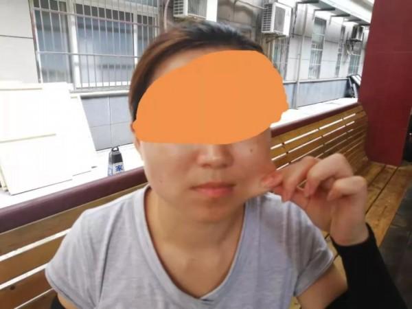 3080元瘦脸针引发300万元索赔