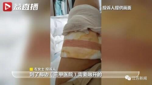 花6万元吸脂后皮肤坏死,双腿凹凸不平!还没修复好,整形医院去哪了?