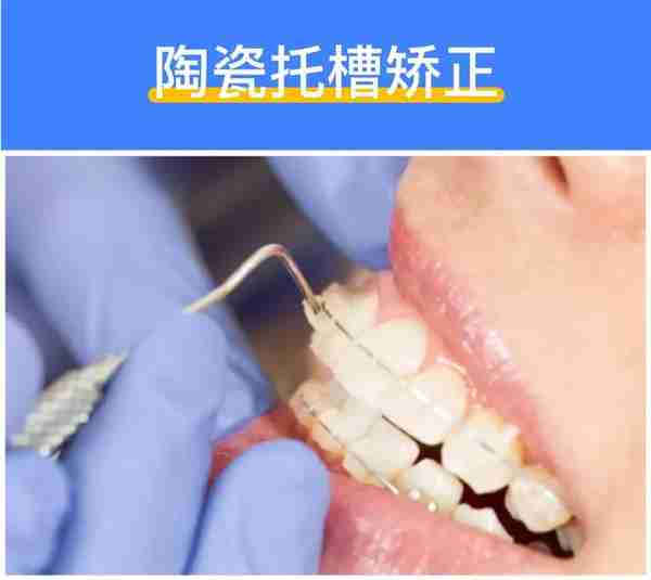 深度揭秘:牙齿矫正到底需要多少钱?