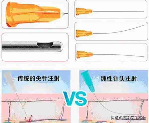 关于玻尿酸隆鼻、填充太阳穴、泪沟,那些医生不会告诉你的