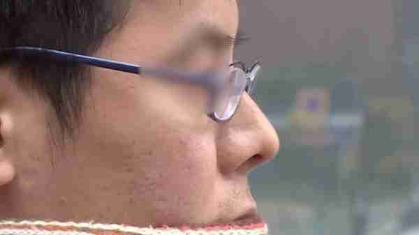 小伙花一万多隆鼻术后假体晃动 医生:很漂亮,比记者的好看!