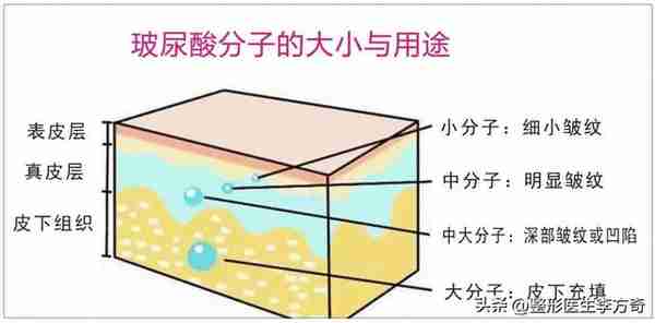 女明星都爱的美容宠儿:玻尿酸的作用与功效是什么?
