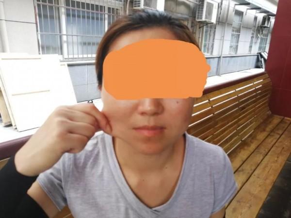 3080元瘦脸针引发300万元索赔