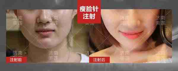 网红名利场,几百块打个瘦脸针,至少月入20多万