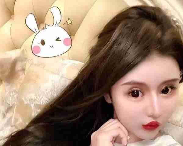 整容失败?网红脸内注射400多针玻尿酸:夏天会融化,冬天会冻住