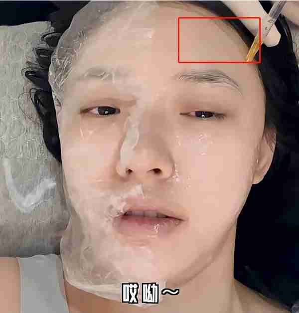 医美水光针、羊胎素盛行,一针58万却供不应求,明星渴望青春永驻