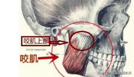 网上那么多“打完瘦脸针,出现面部僵硬、凹陷的”,我都不敢打了