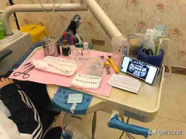 长春15岁女生矫正牙齿拔4颗牙,2个月花近3万终于戴上了牙套
