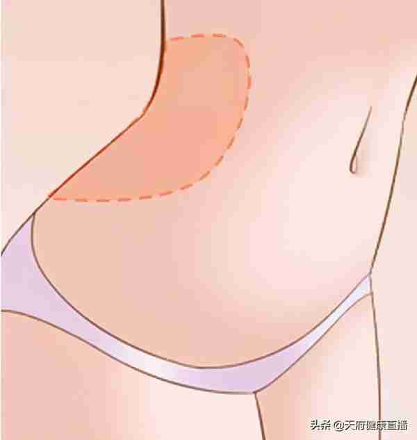 吸脂会让皮肤松垮?脂肪填充会移位?来听听八大处医生怎么说