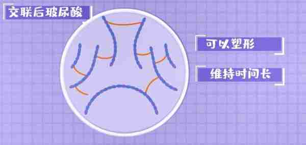 好的玻尿酸拥有哪些特质?种类繁多,玻尿酸该怎么选?