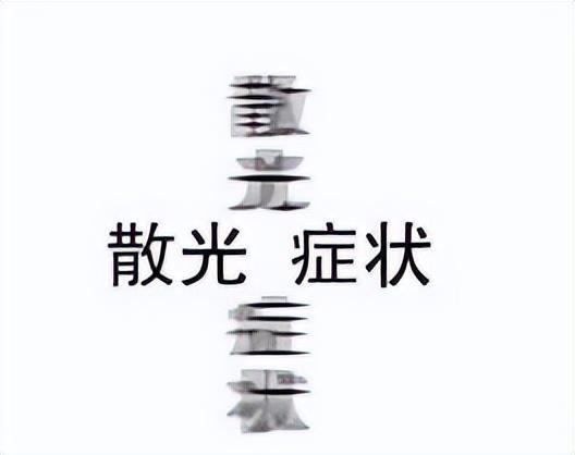 30个孩子6个散光!为什么现在散光的孩子特别多?能彻底治愈吗?