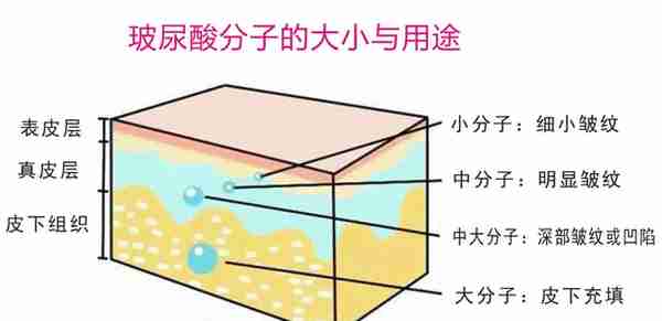 嘴上经常脱口而出的“玻尿酸”,你真的了解它吗?