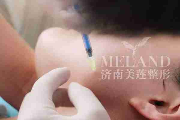 只打了一针瘦脸针,却被全班同学质疑做了吸脂?