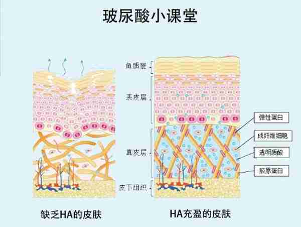 嘴上经常脱口而出的“玻尿酸”,你真的了解它吗?