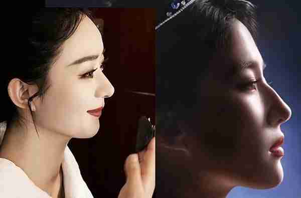 北京20岁女子被叫“大叔”,花6万做鼻子,术后换头,惊艳全家!