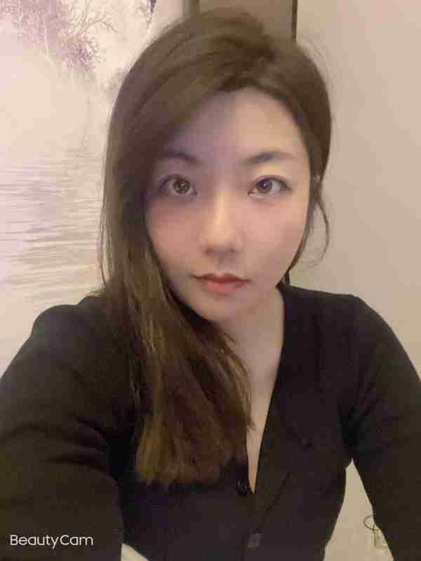 30岁小姐姐做完面部吸脂60天,朋友还以为我悄悄地换了一张脸