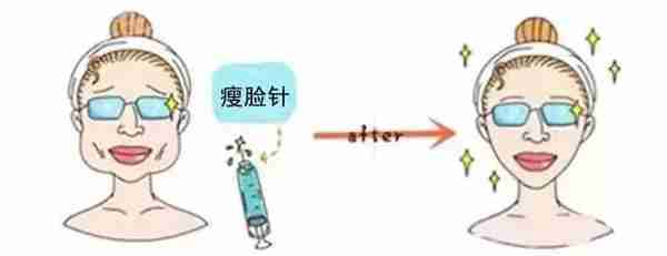 你适合打瘦脸针吗?