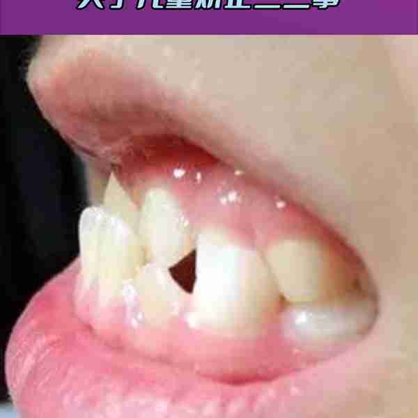 家长别急,儿童牙齿矫正有最佳时间!#口腔