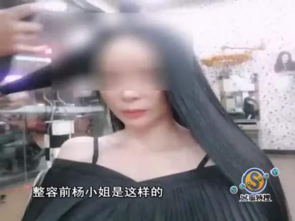 女子花9万元整容结果鼻子歪了 院方人员:去跳楼啊