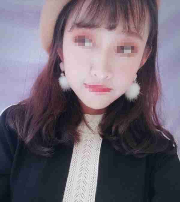 男朋友给20000叫我去隆鼻,我的鼻子真有那么难看吗