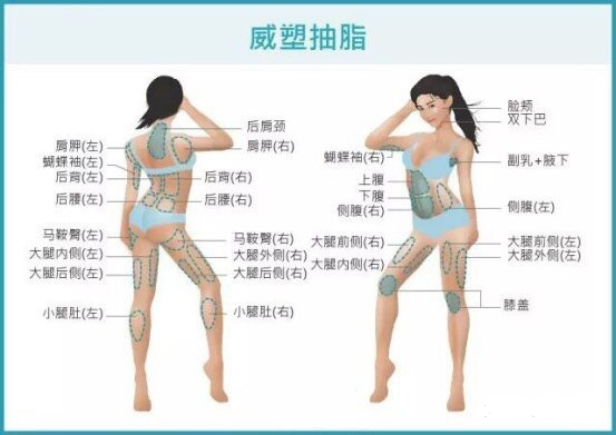 吸脂该如何选择?威塑吸脂有什么危害吗