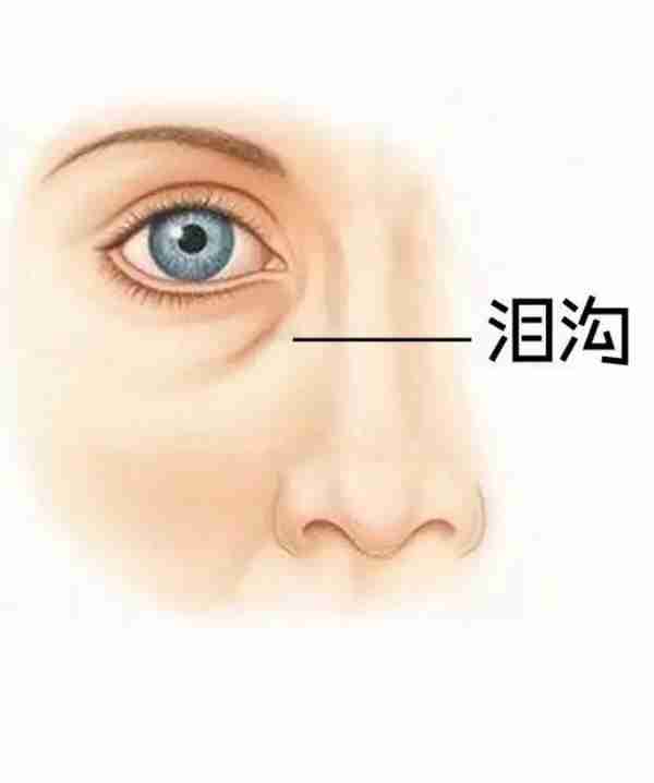 泪沟是怎样形成的?