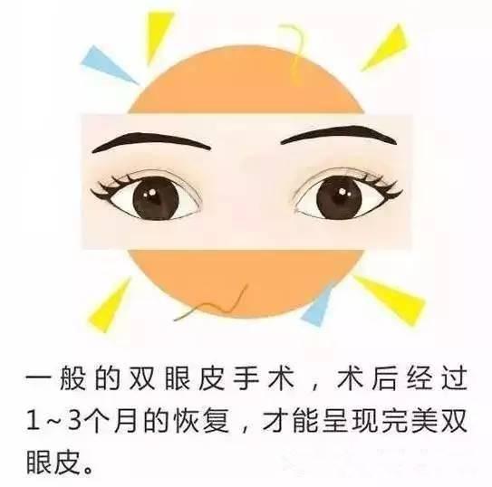 想要做完双眼皮不留痕迹？你需要看这里