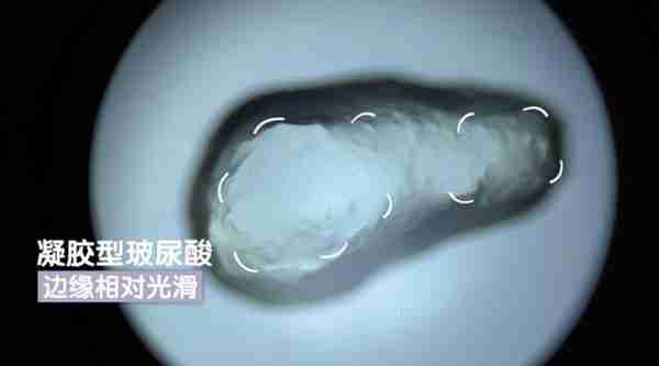 好的玻尿酸拥有哪些特质?种类繁多,玻尿酸该怎么选?