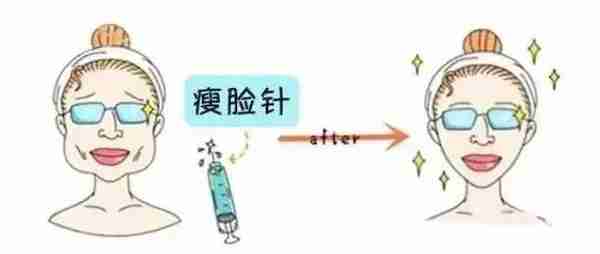 打一次瘦脸针,你的脸能小多少?