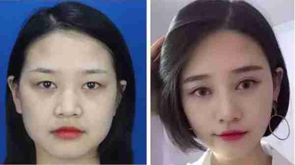 女人眼型大改造,教你如何变大眼萌妹,有了双眼皮颜值提升不少