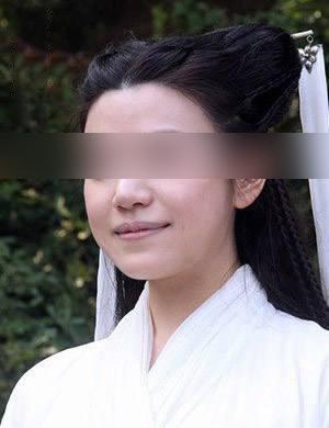 脸大胖十斤!面部吸脂瘦脸真的不会反弹吗?
